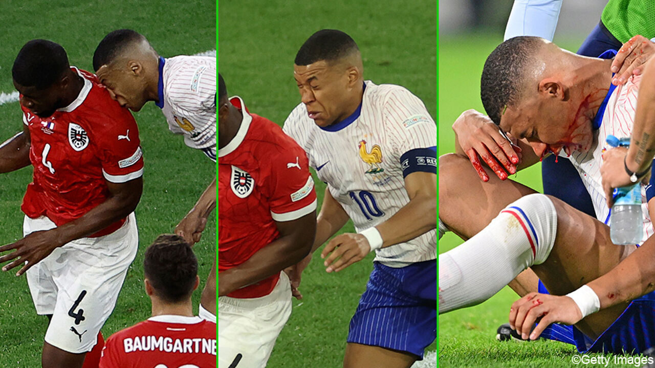 French Star Kylian Mbappé Suffers Broken Nose In European Championship Opener Archysport